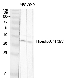 AP-1/Jun D (Phospho-Ser73/100) Polyclonal Antibody