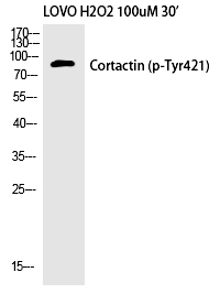 Cortactin (Phospho-Tyr421) Polyclonal Antibody