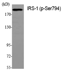 IRS-1 (Phospho-Ser794) Polyclonal Antibody