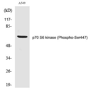 p70 S6 kinase α (Phospho-Ser447) Polyclonal Antibody