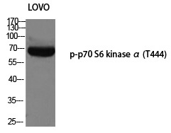 p70 S6 kinase α (Phospho-Thr444) Polyclonal Antibody