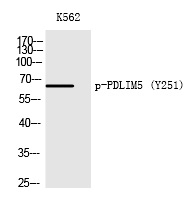 PDLIM5 (Phospho-Tyr251) Polyclonal Antibody