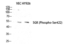 SGK1 (Phospho-Ser422) Polyclonal Antibody