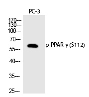 PPAR-γ (Phospho-Ser112) Polyclonal Antibody