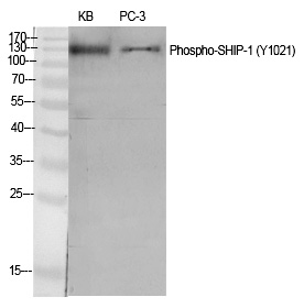 SHIP-1 (Phospho-Tyr1021) Polyclonal Antibody