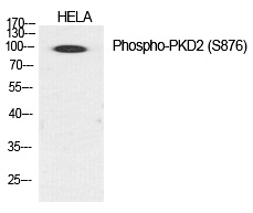 PKD2 (Phospho-Ser876) Polyclonal Antibody