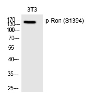 Ron (Phospho-Ser1394) Polyclonal Antibody