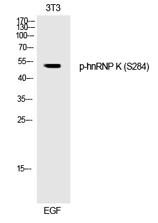 hnRNP K (Phospho-Ser284) Polyclonal Antibody