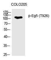 Eg5 (Phospho-Thr926) Polyclonal Antibody