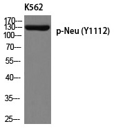 Neu (Phospho-Tyr1112) Polyclonal Antibody