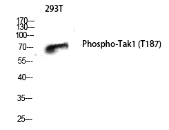 Tak1 (Phospho-Thr187) Polyclonal Antibody