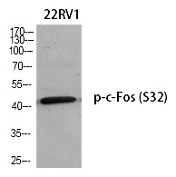 c-Fos (Phospho-Ser32) Polyclonal Antibody