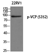 VCP (Phospho-Ser352) Polyclonal Antibody