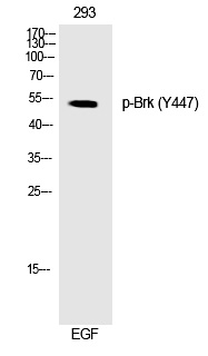 Brk (Phospho-Tyr447) Polyclonal Antibody