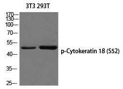 Cytokeratin 18 (Phospho-Ser52) Polyclonal Antibody