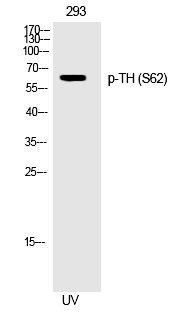 TH (Phospho-Ser62) Polyclonal Antibody