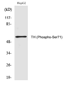 TH (Phospho-Ser71) Polyclonal Antibody