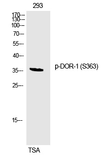 DOR-1 (Phospho-Ser363) Polyclonal Antibody