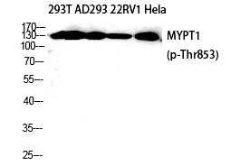 MYPT1 (Phospho-Thr853) Polyclonal Antibody