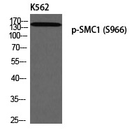 SMC1 (Phospho-Ser966) Polyclonal Antibody