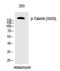 Tuberin (Phospho-Ser939) Polyclonal Antibody