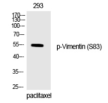 Vimentin (Phospho-Ser83) Polyclonal Antibody