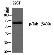 Tak1 (Phospho-Ser439) Polyclonal Antibody