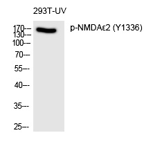 NMDAε2 (Phospho-Tyr1336) Polyclonal Antibody