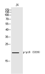 p16 (Phospho-Ser152) Polyclonal Antibody