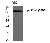 cPLA2 (Phospho-Ser505) Polyclonal Antibody