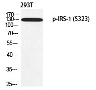 IRS-1 (Phospho-Ser323) Polyclonal Antibody