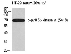 p70 S6 kinase α (Phospho-Ser418) Polyclonal Antibody