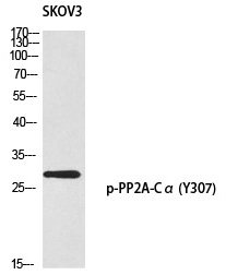 PP2A-Cα (Phospho-Tyr307) Polyclonal Antibody