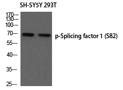 Splicing factor 1 (Phospho-Ser82) Polyclonal Antibody