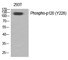 p120 (Phospho-Tyr228) Polyclonal Antibody