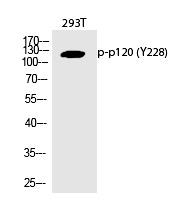 p120 (Phospho-Tyr228) Polyclonal Antibody