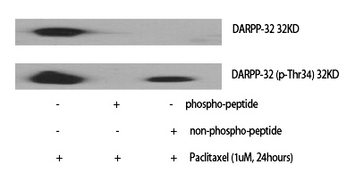 DARPP-32 (Phospho-Thr34) Polyclonal Antibody