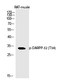 DARPP-32 (Phospho-Thr34) Polyclonal Antibody