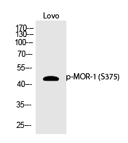 MOR-1 (Phospho-Ser375) Polyclonal Antibody