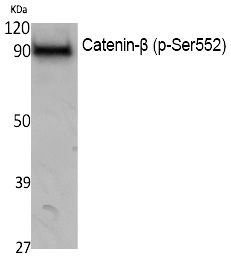 Catenin-β (Phospho-Ser552) Polyclonal Antibody - SAB | Signalway Antibody