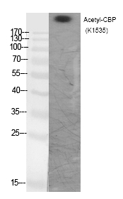 CBP (Acetyl-Lys1535) Polyclonal Antibody