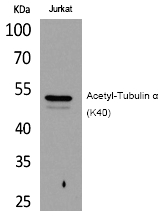 Tubulin α (Acetyl-Lys40) Polyclonal Antibody