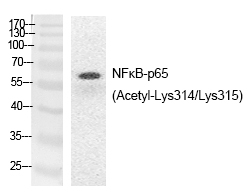 NFκB-p65 (Acetyl-Lys314/Lys315) Polyclonal Antibody