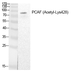 PCAF (Acetyl-Lys428) Polyclonal Antibody