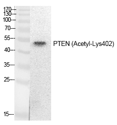 PTEN (Acetyl-Lys402) Polyclonal Antibody