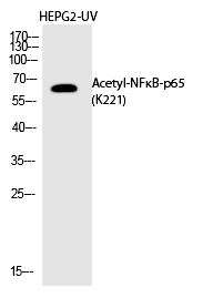 NFκB-p65 (Acetyl-Lys221) Polyclonal Antibody