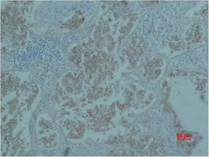 Catenin-β Monoclonal Antibody