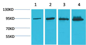 Catenin-β Monoclonal Antibody