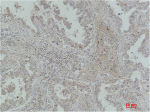 MICU1 Monoclonal Antibody