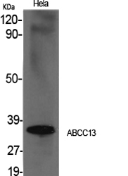 ABCC13 Polyclonal Antibody